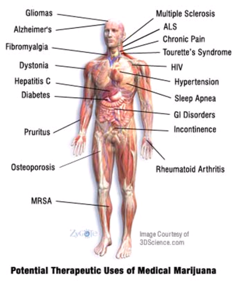 The Cannabinoids in the Cannabis plant are very beneficial for inflammation, which is a major component in many chronic diseases. Chronic inflammation leads to chronic disease.